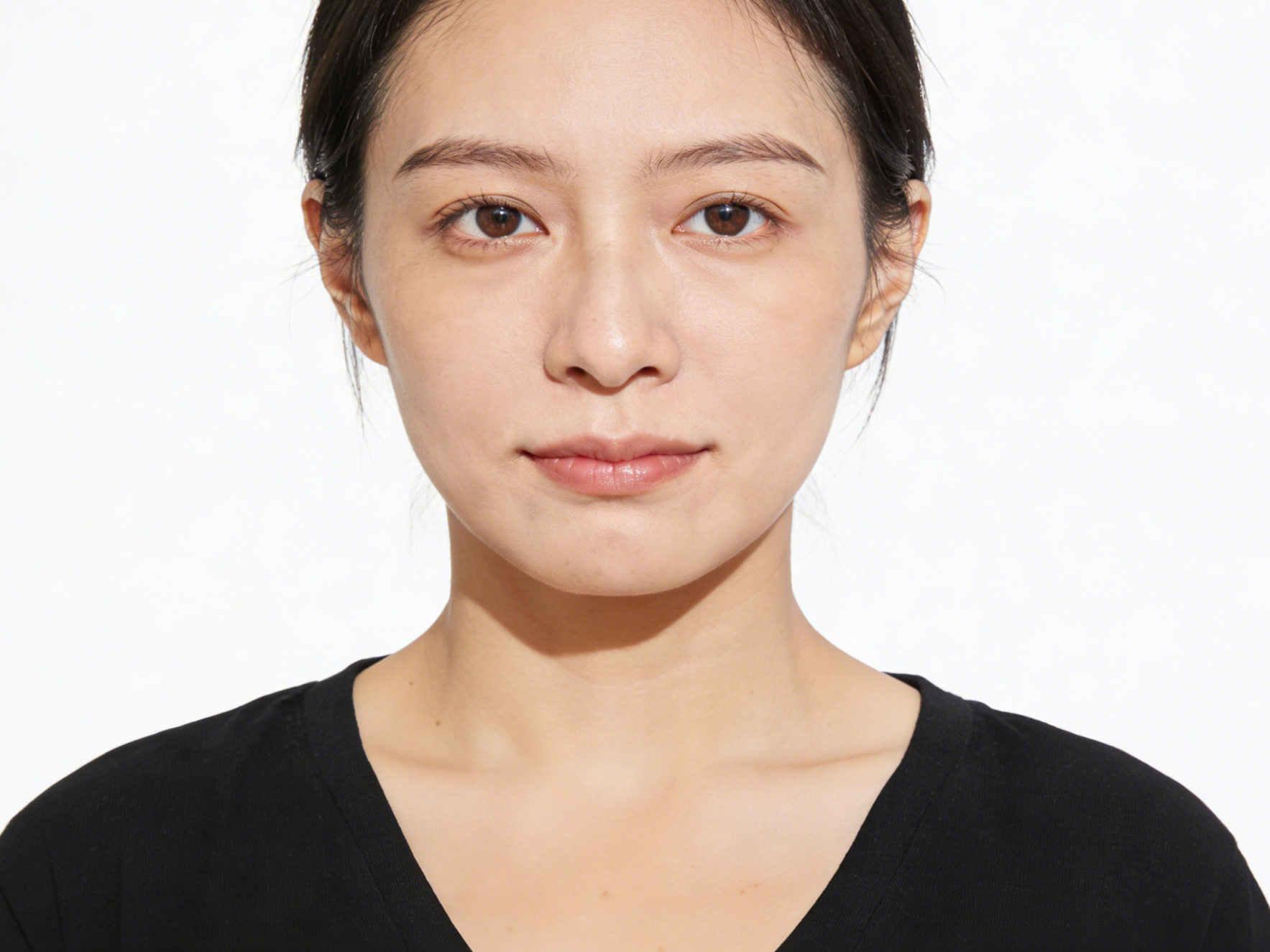 Victoria Beauty GLOW² 療程前後對比 - 毛孔精細、黑頭清除及即時水潤透亮效果Victoria Beauty before and after GLOW² treatment - refined pores, removed blackheads and instant hydrated glow