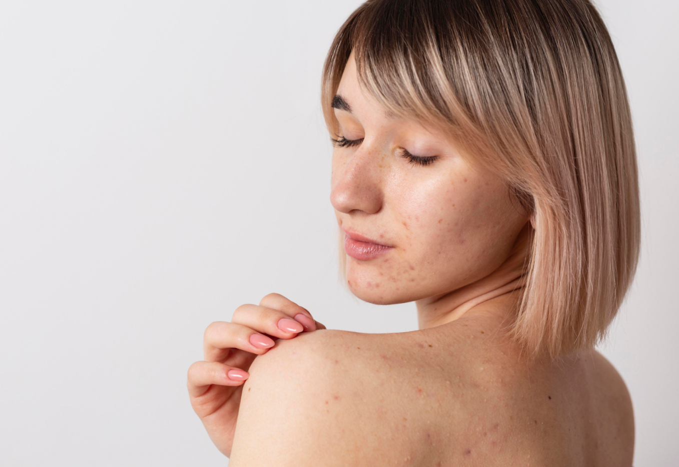 Victoria Beauty GLOW² 療程前後對比 - 毛孔精細、黑頭清除及即時水潤透亮效果Victoria Beauty before and after GLOW² treatment - refined pores, removed blackheads and instant hydrated glow