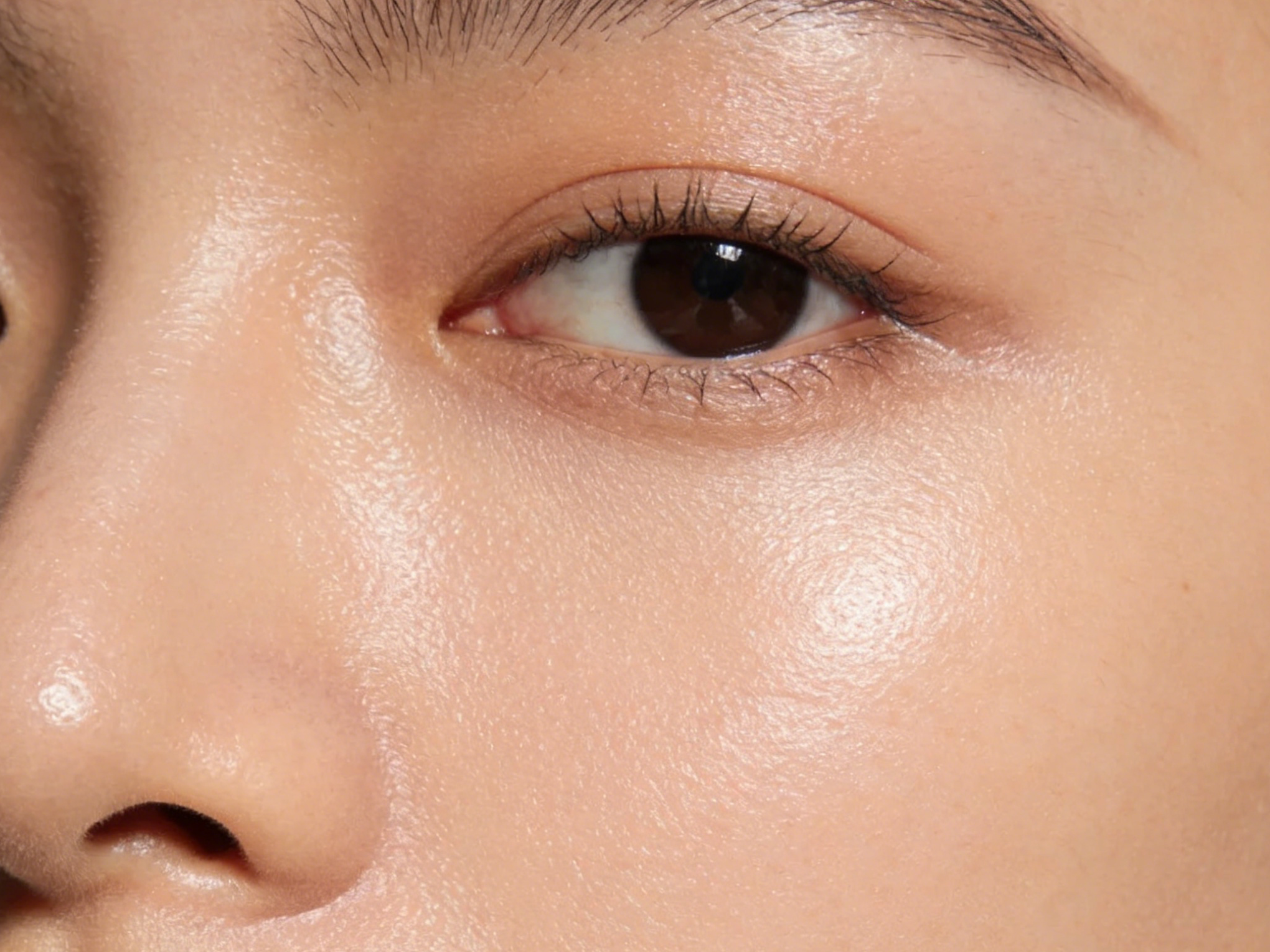 Victoria Beauty GLOW² 療程前後對比 - 毛孔精細、黑頭清除及即時水潤透亮效果Victoria Beauty before and after GLOW² treatment - refined pores, removed blackheads and instant hydrated glow