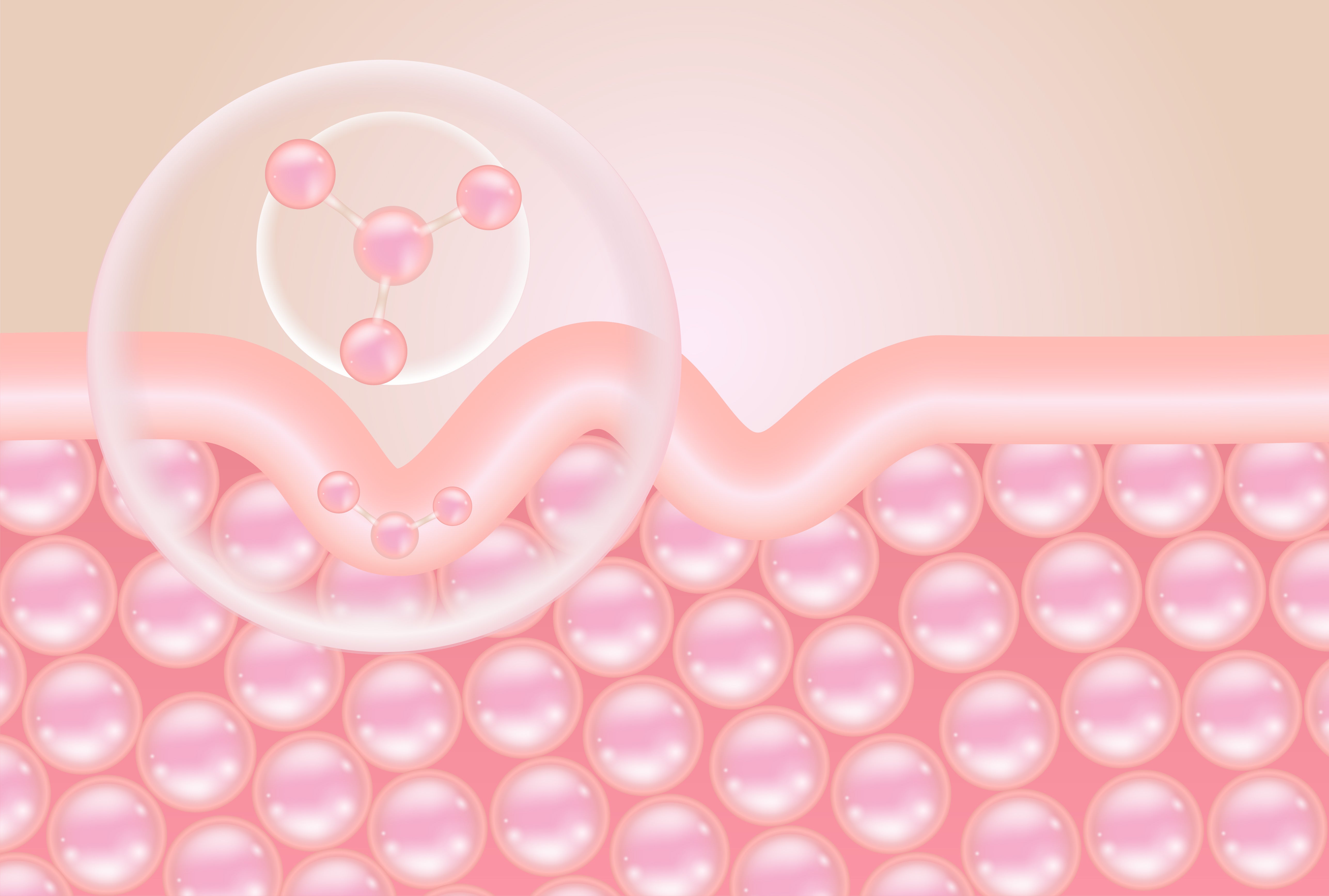 Victoria Beauty 暗瘡四大成因圖解 - 皮脂過分泌、角質紊亂、痤瘡桿菌繁殖及炎症過激機制Victoria Beauty four root causes of acne - excessive sebum, keratin disorder, bacterial proliferation and inflammatory response