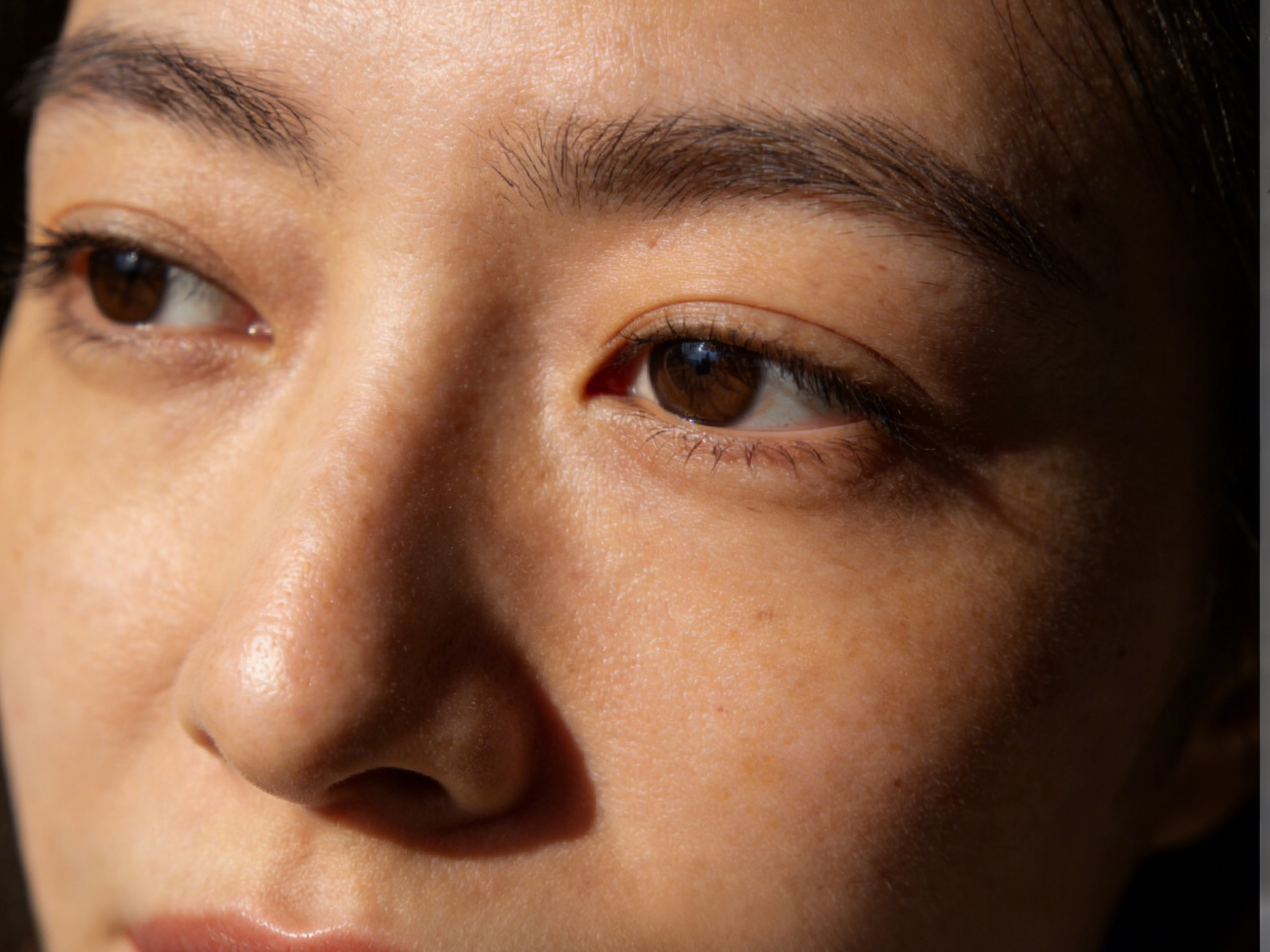 Victoria Beauty GLOW² 療程前後對比 - 毛孔精細、黑頭清除及即時水潤透亮效果Victoria Beauty before and after GLOW² treatment - refined pores, removed blackheads and instant hydrated glow