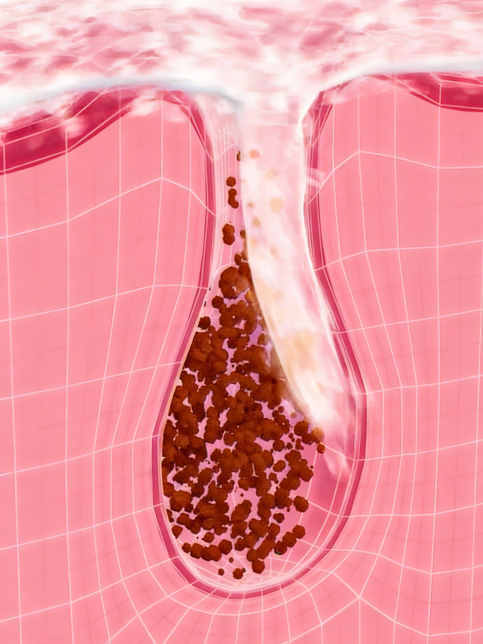 Victoria Beauty GLOW² 微米毛孔槍儀器 - 360 度雙螺旋噴射結合負壓真空無創深層清潔技術Victoria Beauty GLOW² micro-pore gun device - 360-degree spiral micro-jet and vacuum suction for deep pore cleansing