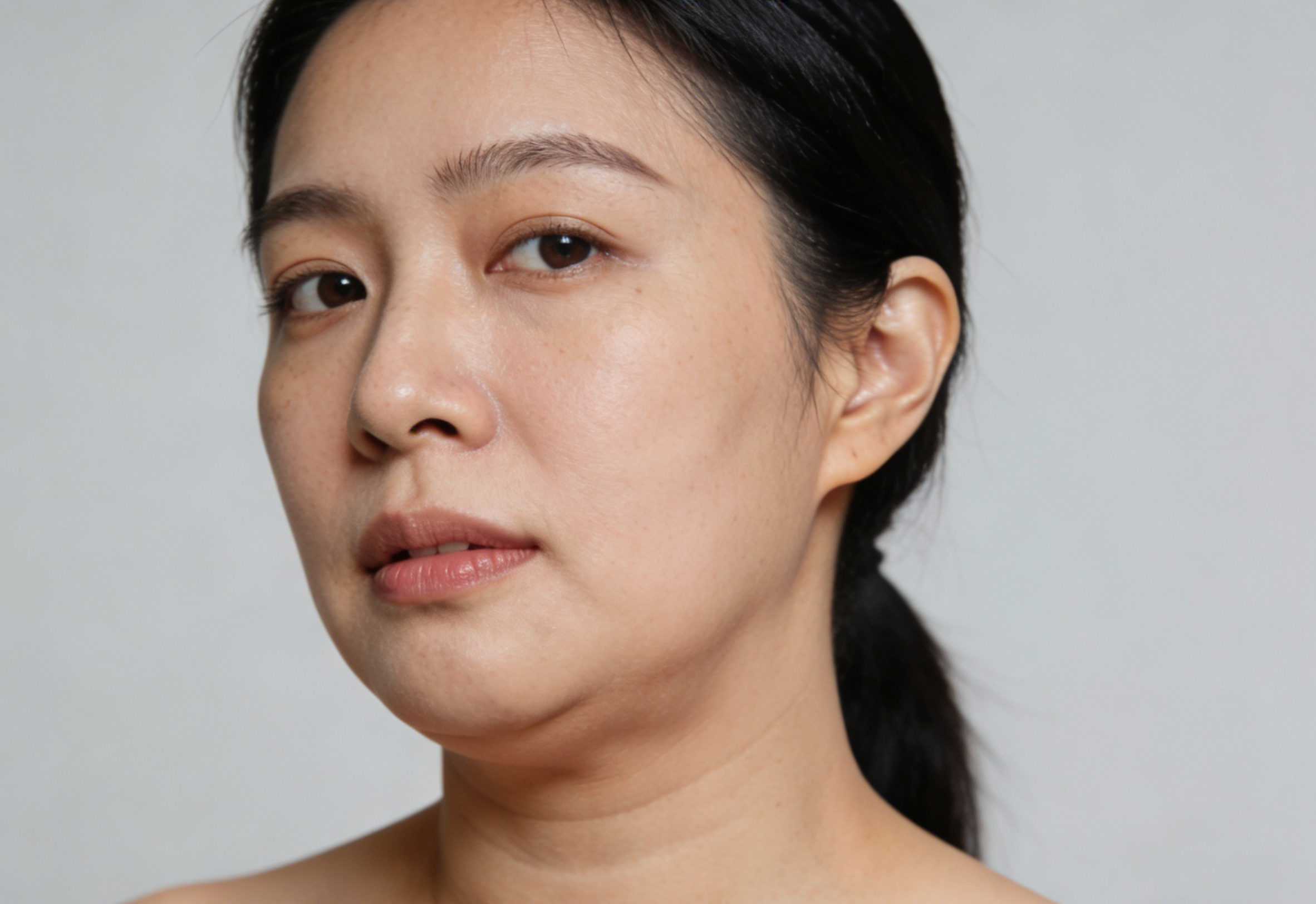 Victoria Beauty GLOW² 療程前後對比 - 毛孔精細、黑頭清除及即時水潤透亮效果Victoria Beauty before and after GLOW² treatment - refined pores, removed blackheads and instant hydrated glow