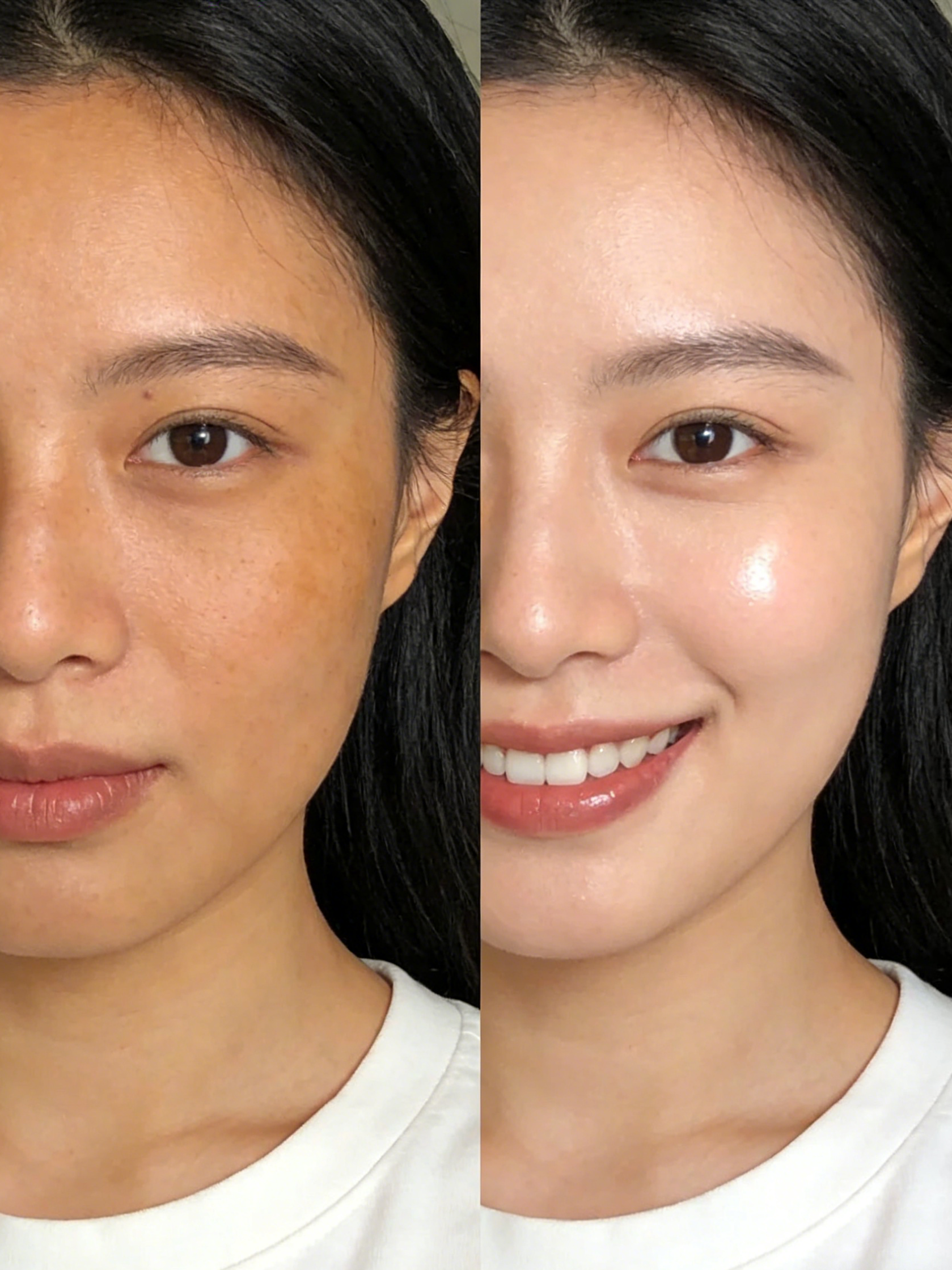 Victoria Beauty GLOW² 微米毛孔槍儀器 - 360 度雙螺旋噴射結合負壓真空無創深層清潔技術Victoria Beauty GLOW² micro-pore gun device - 360-degree spiral micro-jet and vacuum suction for deep pore cleansing